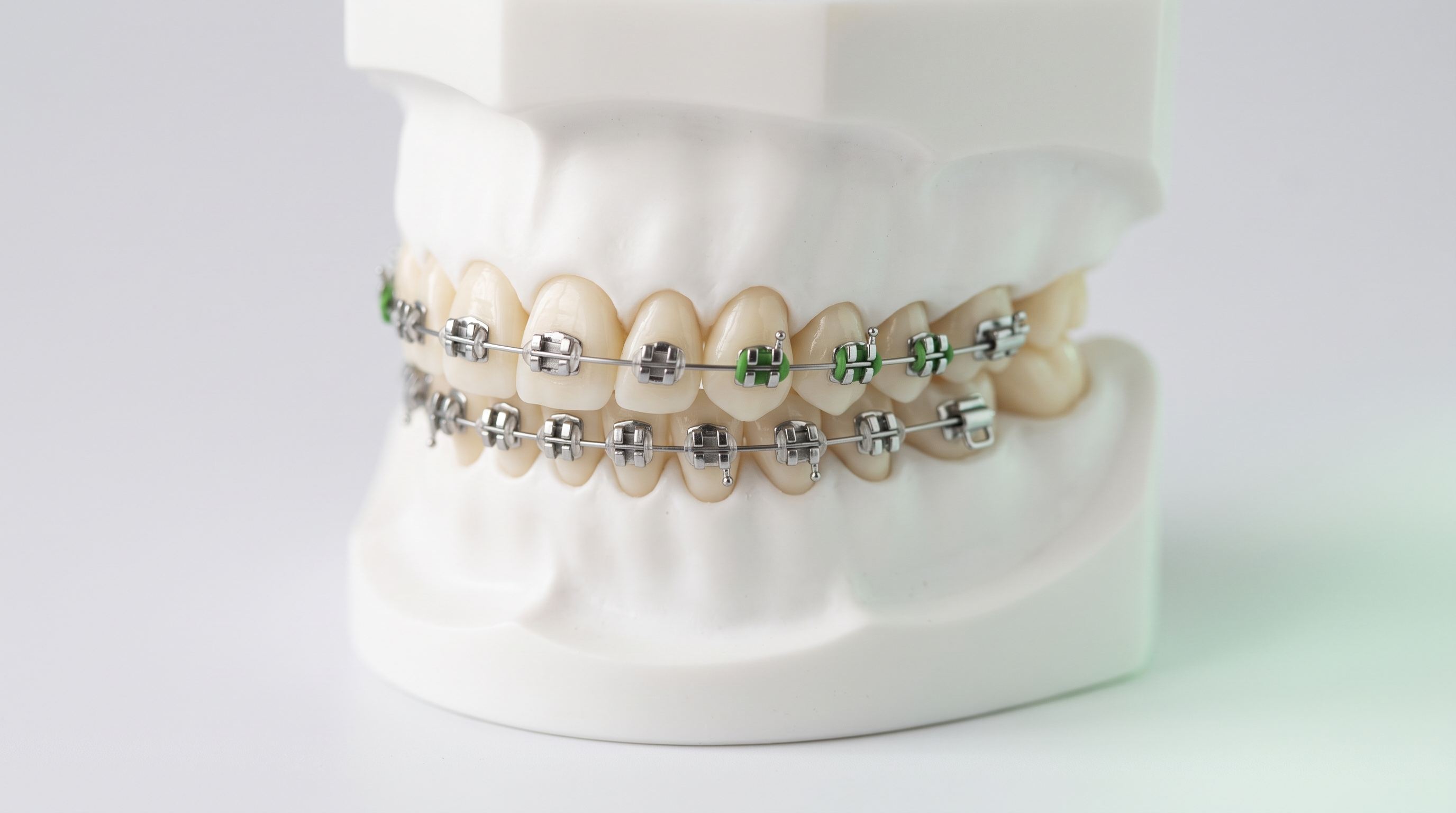 Alt ve üst dişlerinde metal braket ve tel bulunan çene modeli, yakın plan