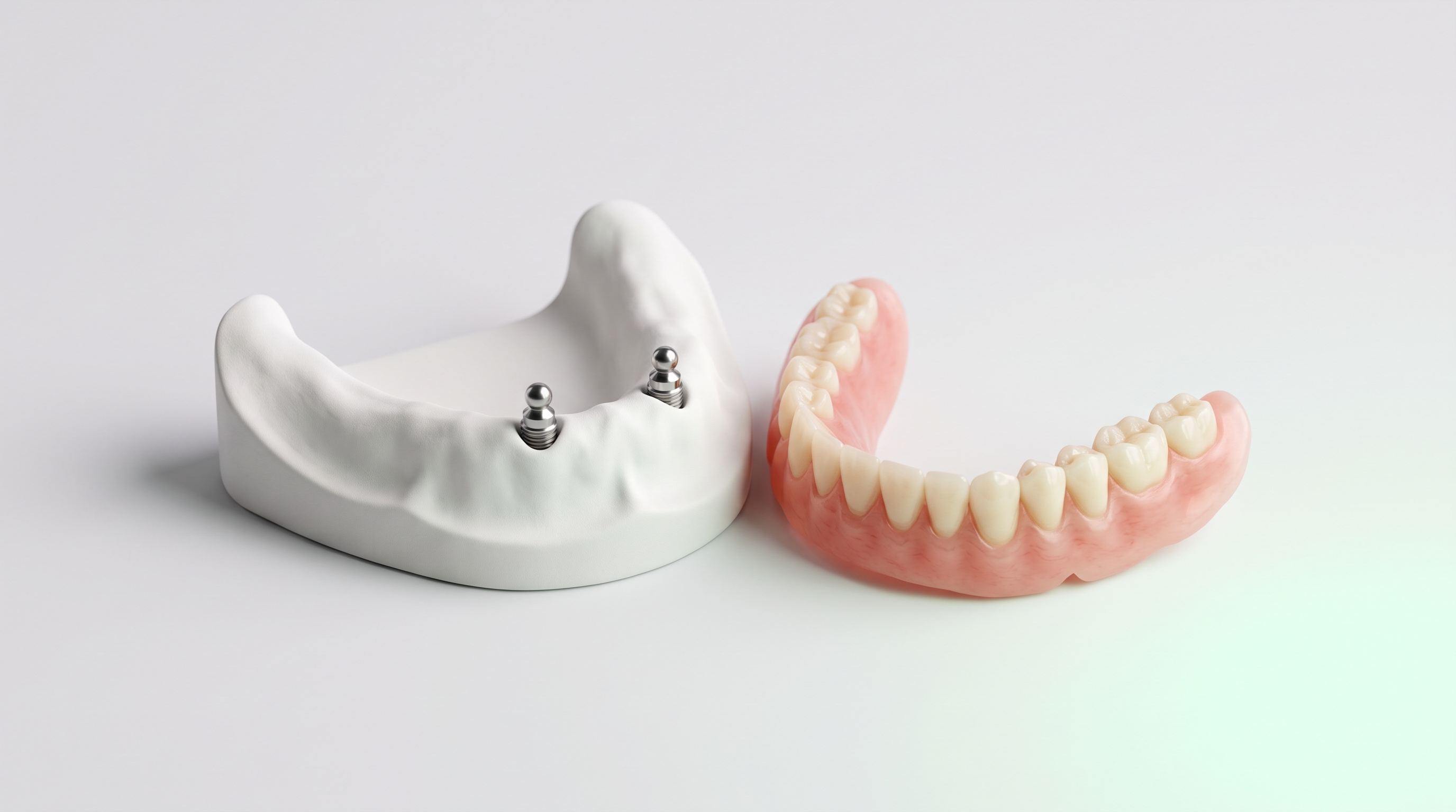 İki implantında top başlıklı bağlantı parçası olan dişsiz alt çene modeli ve yanında hareketli alt protez